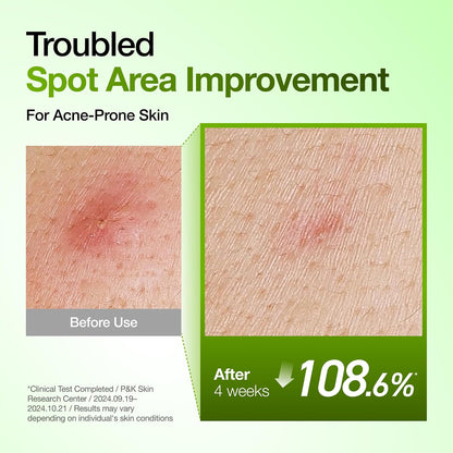 ANUA Azelaic Acid 10 Hyaluron Redness Soothing Serum 30ml | ANUA Azelaic Acid 10% হায়ালুরন রেডনেস সুথিং সিরাম