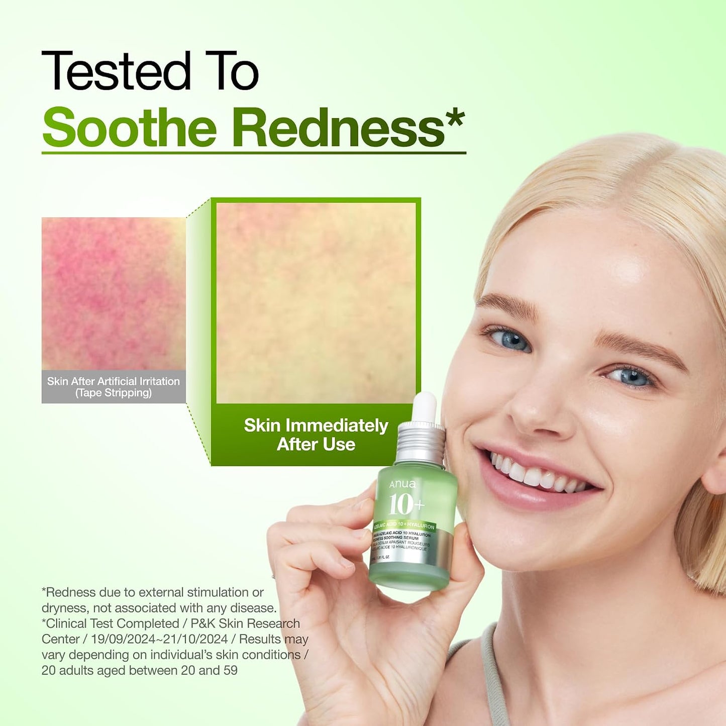 ANUA Azelaic Acid 10 Hyaluron Redness Soothing Serum 30ml | ANUA Azelaic Acid 10% হায়ালুরন রেডনেস সুথিং সিরাম