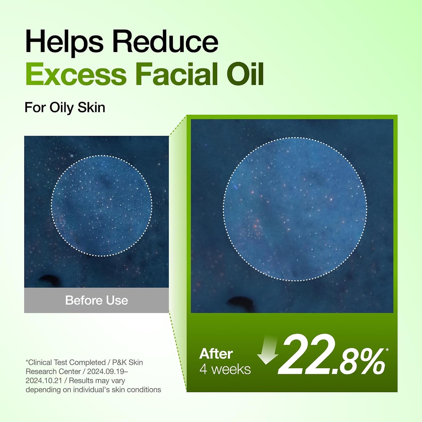 ANUA Azelaic Acid 10 Hyaluron Redness Soothing Serum 30ml | ANUA Azelaic Acid 10% হায়ালুরন রেডনেস সুথিং সিরাম