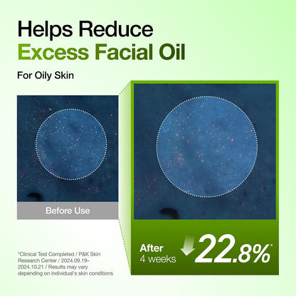 ANUA Azelaic Acid 10 Hyaluron Redness Soothing Serum 30ml | ANUA Azelaic Acid 10% হায়ালুরন রেডনেস সুথিং সিরাম