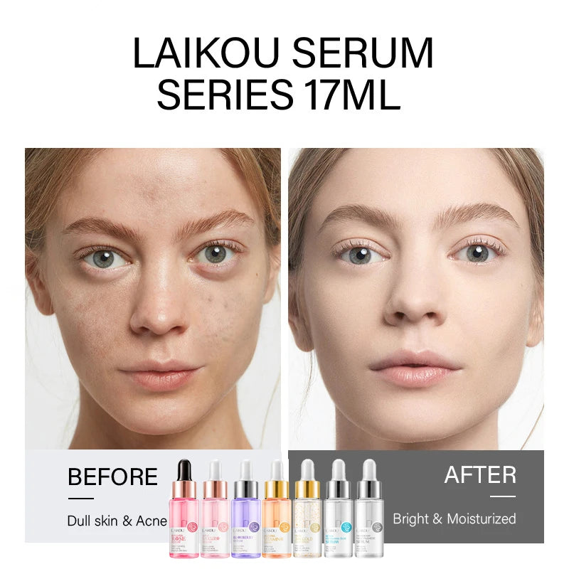 LAIKOU 7 Bottles 24K Gold Snail Sakura Hyluronic Acid Vitamin C Nicotinamida Rose Blueberry Serum Japan Essential Face Essences