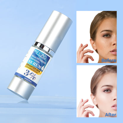 MELAO 3% Niacinamide Whitening Serum 30ml | MELAO 3% নায়াসিনামাইড হোয়াইটেনিং সিরাম