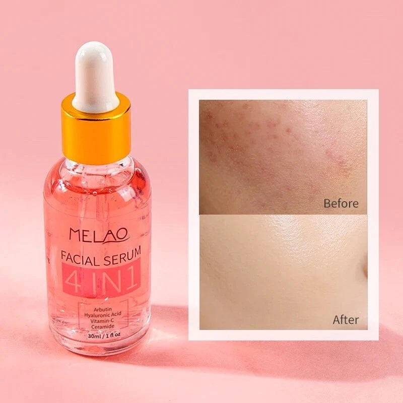 MELAO 4 IN 1 Facial Serum 30ml | MELAO ৪-ইন-১ ফেসিয়াল সিরাম