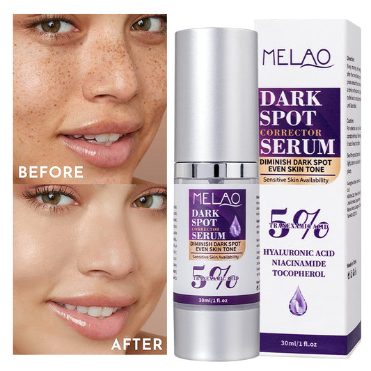 MELAO 5% Tranexamic Acid Brightening Serum | MELAO 5% ট্রানেক্সামিক অ্যাসিড ব্রাইটেনিং সিরাম
