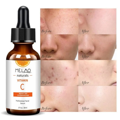MELAO Professional Vitamin C Serum 20% and Hyaluronic Acid 30ml | MELAO প্রফেশনাল ভিটামিন C 20% + হায়ালুরোনিক অ্যাসিড সিরাম