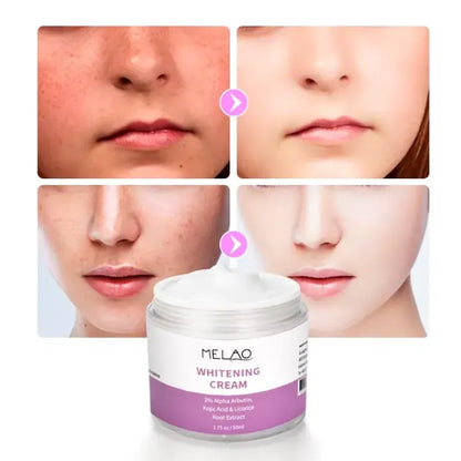 MELAO 2% Alpha Arbutin Brightening Cream 50ml | MELAO ২% আলফা আরবুটিন ব্রাইটেনিং ক্রিম