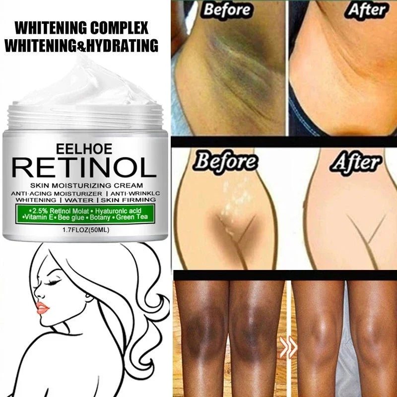 Body Whitening Cream Private Parts Underarm Bleaching Serum Whiten Butt Knee Brighten Inner Thigh Intimate Dark Remove Melanin