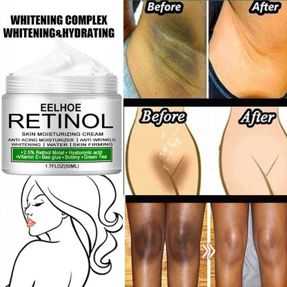 Body Whitening Cream Private Parts Underarm Bleaching Serum Whiten Butt Knee Brighten Inner Thigh Intimate Dark Remove Melanin
