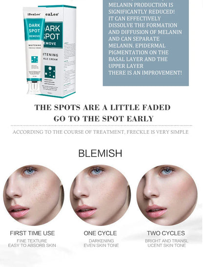 Whitening Freckle Cream Remove Dark Spots Remove Melasma Anti Freckle Cream Fade Pigmentation Anti-Aging Light Skin Care