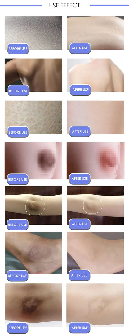 Body Whitening Cream Private Parts Underarm Bleaching Serum Whiten Butt Knee Brighten Inner Thigh Intimate Dark Remove Melanin