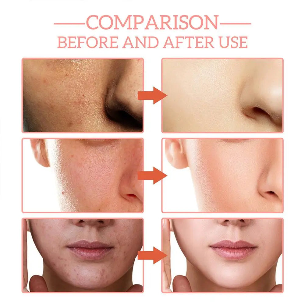 5 In 1 Fade Fine Lines Firming Face Serum Moisturizing Brightening Vitamin C Hyaluronic Acid Facial Serum Shrink Pores Skin Care