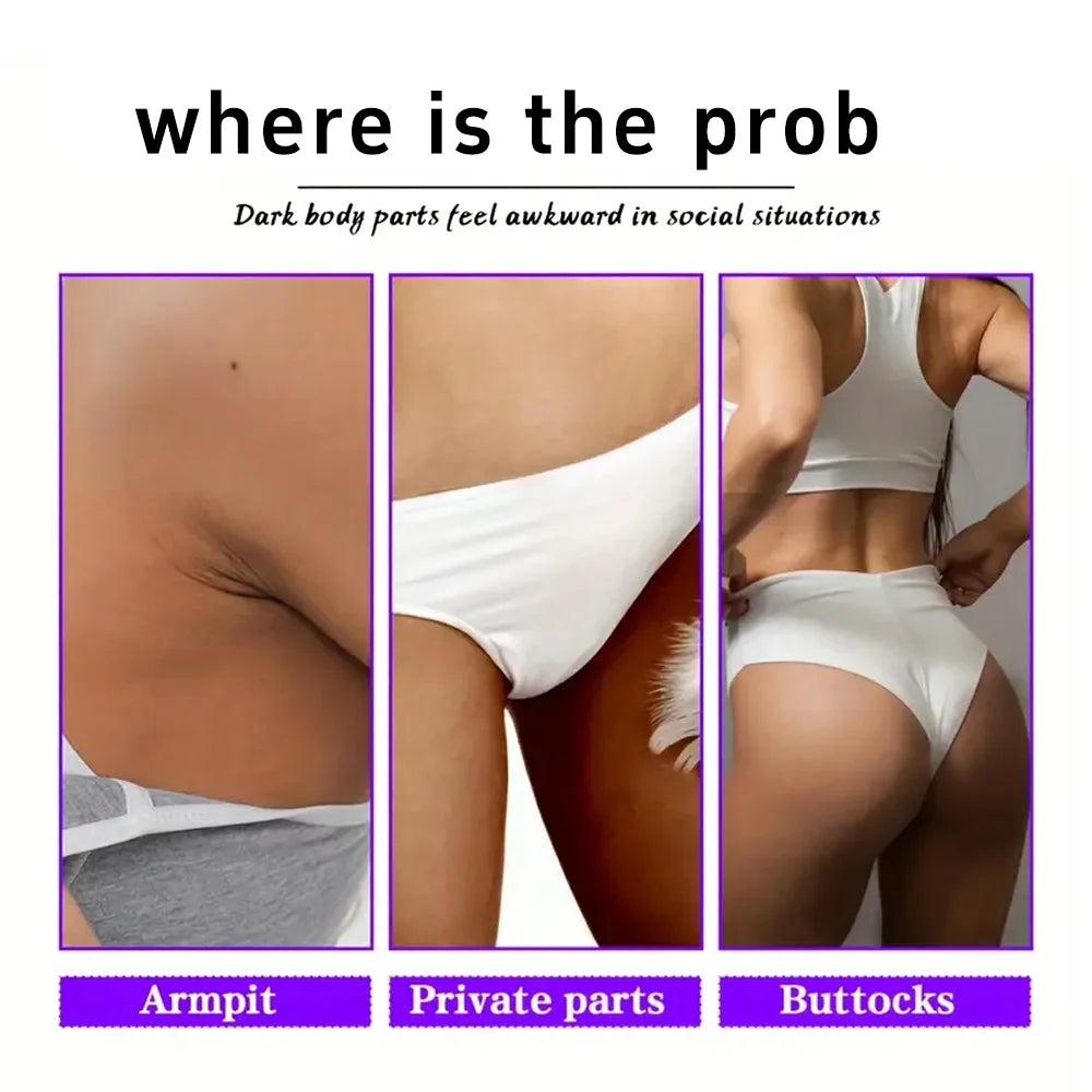 Whitening Cream Private Parts Underarm Bleaching serum Whiten Butt KneeBrighten Inner Thigh intimate Parts Dark Remove Melanin