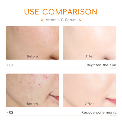 LAIKOU Vitamin C Facial Serum Essence Hydrating and Moisturizing VC Face Essence Skin Care