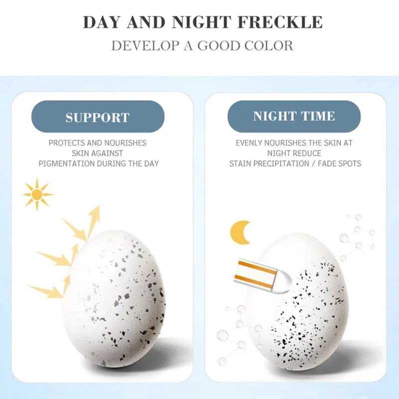 Whitening Freckle Cream Remove Dark Spots Remove Melasma Anti Freckle Cream Fade Pigmentation Anti-Aging Light Skin Care