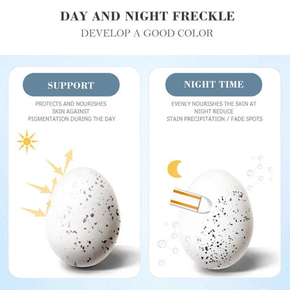 Whitening Freckle Cream Remove Dark Spots Remove Melasma Anti Freckle Cream Fade Pigmentation Anti-Aging Light Skin Care