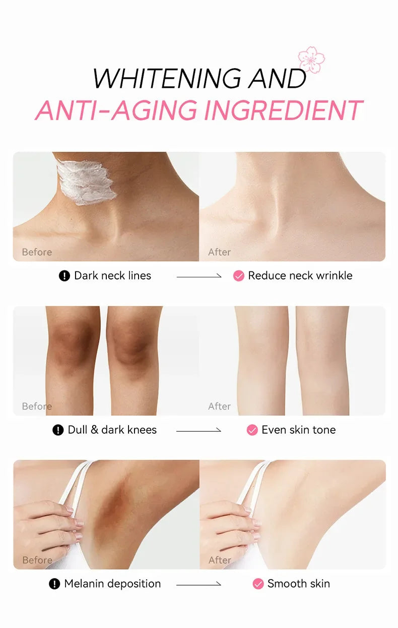 Laikou Sakura Underarm Cream Knee Buttocks Dark Skin  Improve Melanin Pigmentation Korean Skin Care Product 30g