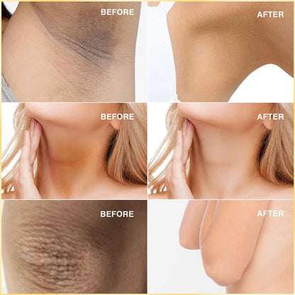 Body Whitening Cream Private Parts Underarm Bleaching Serum Whiten Butt Knee Brighten Inner Thigh Intimate Dark Remove Melanin