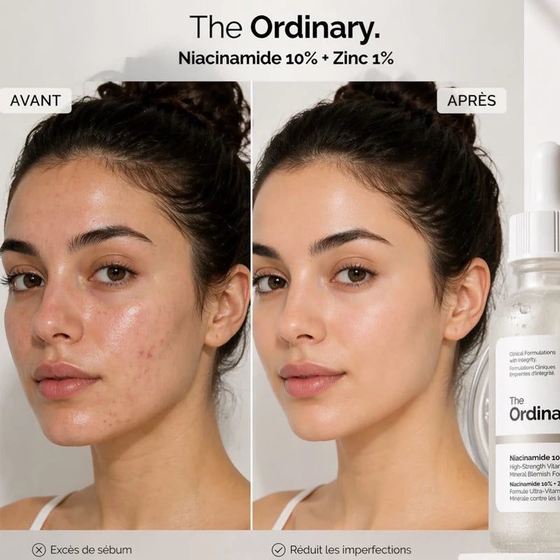 The Ordinary Niacinamide 10% + Zinc 1% Serum 30ml Essence Suitable for Acne-prone Skin Can Smooth Brighten Support The Skin
