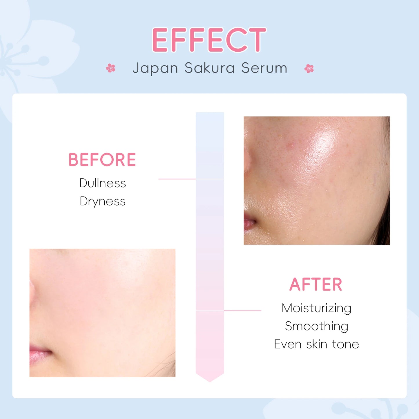 LAIKOU Sakura Serum Shrink Pores Remove Acne Skin Rejuvenation Whitening Essence