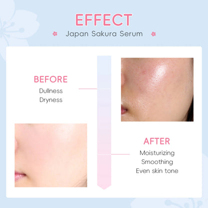 LAIKOU Sakura Serum Shrink Pores Remove Acne Skin Rejuvenation Whitening Essence