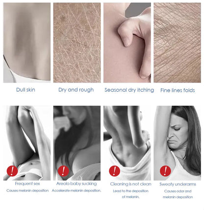 Body Whitening Cream Private Parts Underarm Bleaching Serum Whiten Butt Knee Brighten Inner Thigh Intimate Dark Remove Melanin