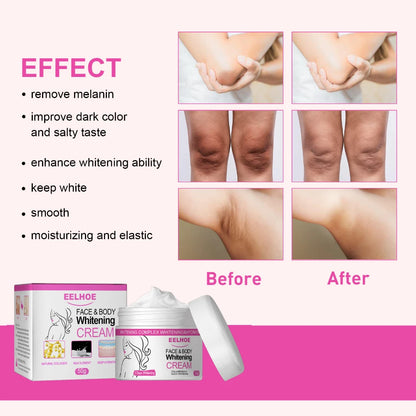 Body Whitening Cream Private Parts Underarm Bleaching Serum Remove Melanin Pigmentation Brighten Inner Thigh Intimate Dark