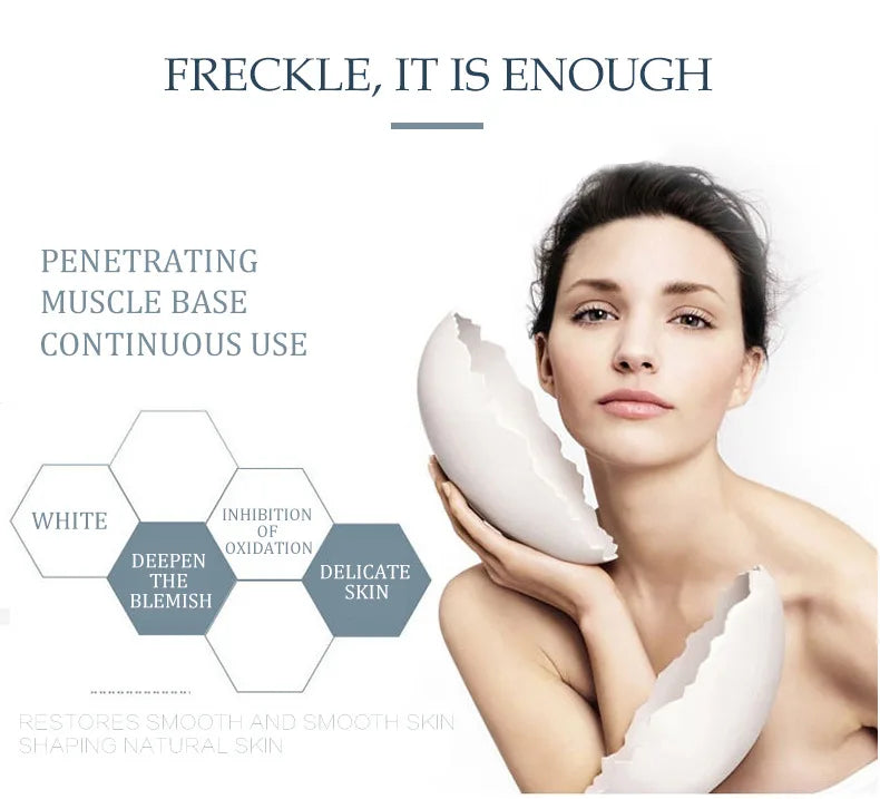 Whitening Freckle Cream Remove Dark Spots Remove Melasma Anti Freckle Cream Fade Pigmentation Anti-Aging Light Skin Care