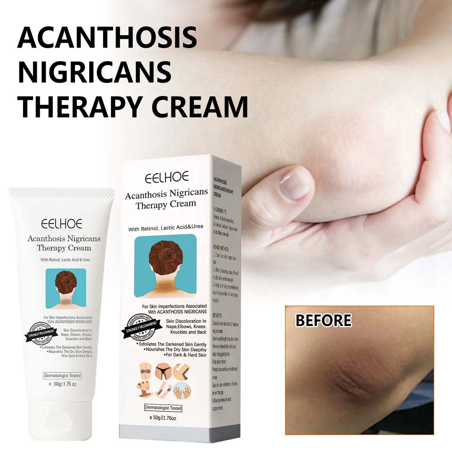 Whitening Cream Brightening Skin for Dark Skin Lightening Neck Arm Knee Joint Underarm Elbow Moisturizing Body Care Products