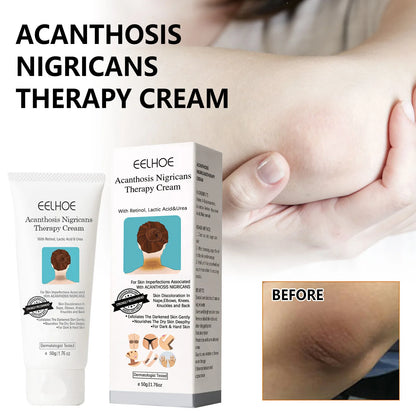 Whitening Cream Brightening Skin for Dark Skin Lightening Neck Arm Knee Joint Underarm Elbow Moisturizing Body Care Products