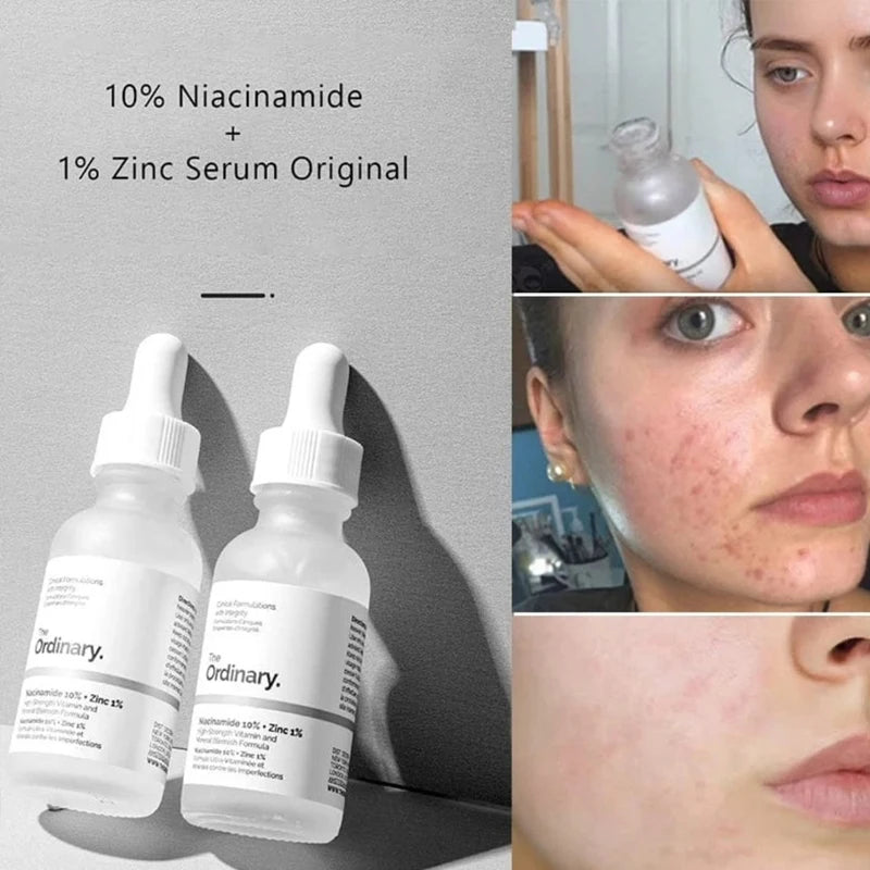 The Ordinary Niacinamide 10% + Zinc 1% Serum 30ml Essence Suitable for Acne-prone Skin Can Smooth Brighten Support The Skin