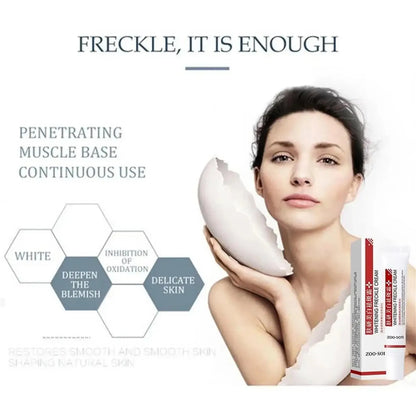Whiten Cream Brighten Face Effective Remove Melasma Dark Spot Improve Dullness Skin Anti-pigmentation Care Cream Care Products