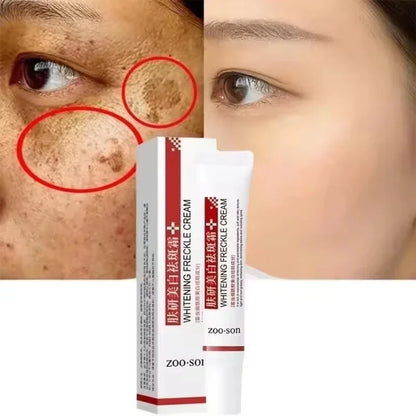 Whiten Cream Brighten Face Effective Remove Melasma Dark Spot Improve Dullness Skin Anti-pigmentation Care Cream Care Products
