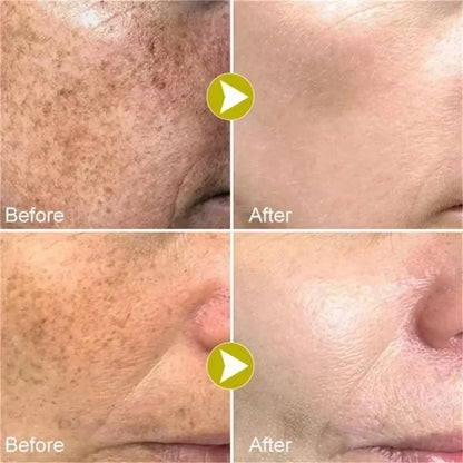 Whiten Cream Brighten Face Effective Remove Melasma Dark Spot Improve Dullness Skin Anti-pigmentation Care Cream Care Products