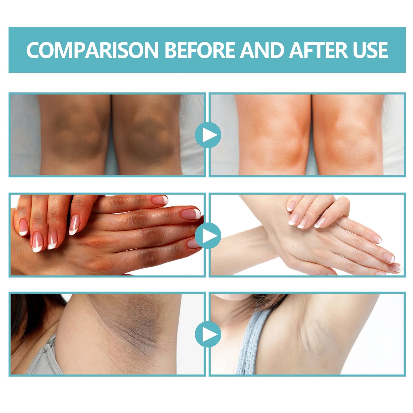 Whitening Cream Brightening Skin for Dark Skin Lightening Neck Arm Knee Joint Underarm Elbow Moisturizing Body Care Products