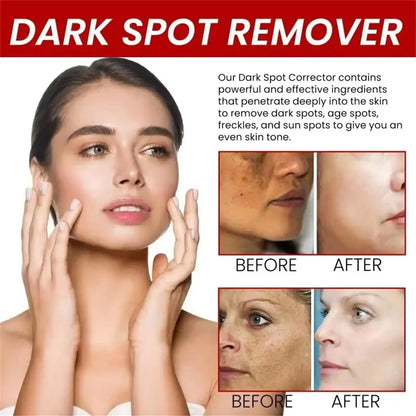 Whiten Cream Brighten Face Effective Remove Melasma Dark Spot Improve Dullness Skin Anti-pigmentation Care Cream Care Products