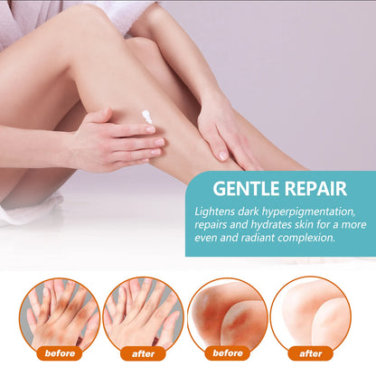 Whitening Cream Brightening Skin for Dark Skin Lightening Neck Arm Knee Joint Underarm Elbow Moisturizing Body Care Products