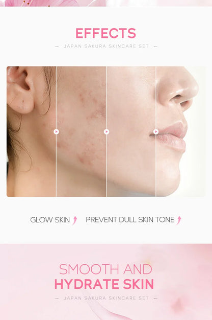 LAIKOU Sakura Kit Skin Care Sets Moisturizing and Reducing Fine Lines Cleansing Pore Product 5-Piece Korean Women's Day Gift