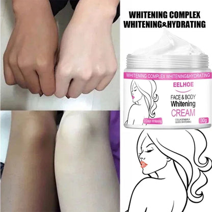 Body Whitening Cream Private Parts Underarm Bleaching Serum Remove Melanin Pigmentation Brighten Inner Thigh Intimate Dark
