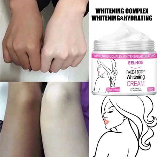 Body Whitening Cream Private Parts Underarm Bleaching Serum Remove Melanin Pigmentation Brighten Inner Thigh Intimate Dark