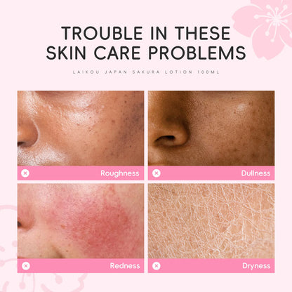 LAIKOU Sakura Face Lotion Moisturizing Essence  Shrink Pores Repairing  Improve Skin Elasticity  100ML
