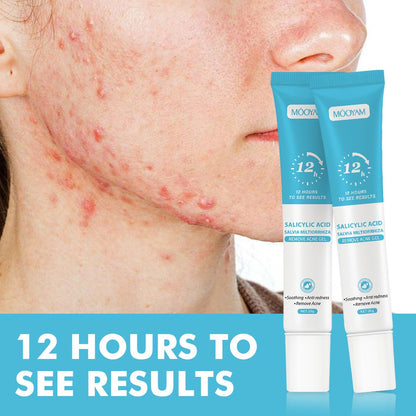 MOOYAM Salicylic Acid Acne Clear Face Wash | MOOYAM স্যালিসাইলিক অ্যাসিড অ্যাকনে কেয়ার ফেস ওয়াশ