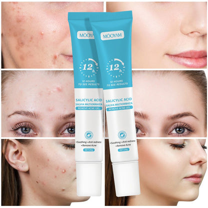 MOOYAM Salicylic Acid Acne Clear Face Wash | MOOYAM স্যালিসাইলিক অ্যাসিড অ্যাকনে কেয়ার ফেস ওয়াশ